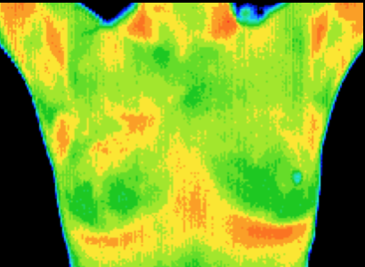 Thermography example
